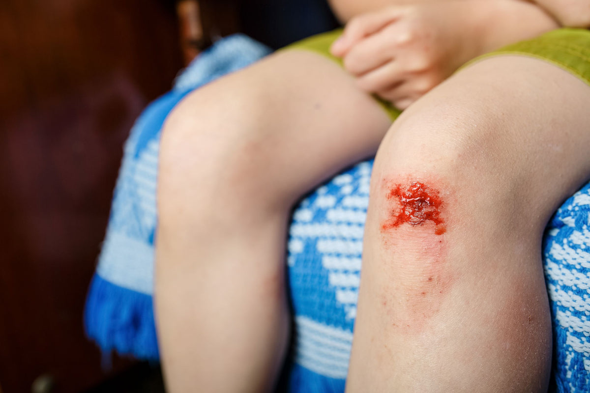 Granulating Wounds: 3 Ways To Optimize Healing