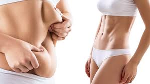 tummy tuck woundvite