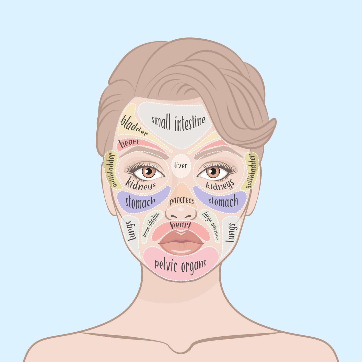 hormonal acne areas