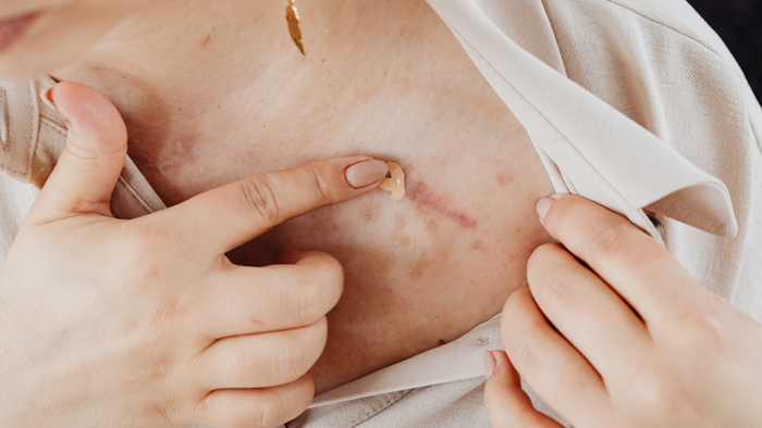 Examining Post-Surgery Recovery Scar