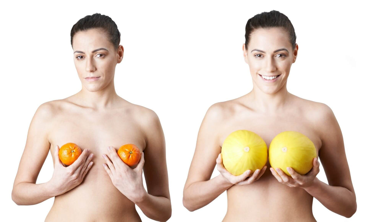 Large Breast Augmentation: Benefits and Downsides