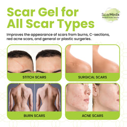 ScarMedx®